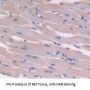 Fatty Acid Binding Protein 4, Adipocyte (FABP4) Antibody