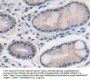 Methionine Adenosyltransferase II Alpha (MAT2a) Antibody