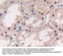 Methionine Adenosyltransferase II Alpha (MAT2a) Antibody