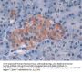 Methionine Adenosyltransferase II Alpha (MAT2a) Antibody