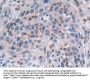 Methionine Adenosyltransferase II Alpha (MAT2a) Antibody