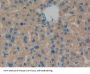 Carnitine Palmitoyltransferase 1A, Liver (CPT1A) Antibody