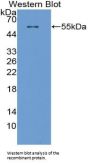 CPT1A Antibody