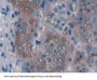 CPT1A Antibody