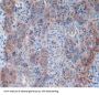 CPT1A Antibody