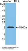 Glyceraldehyde-3-Phosphate Dehydrogenase (GAPDH) Antibody