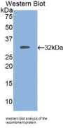 Multidrug Resistance Associated Protein 1 (ABCC1) Antibody