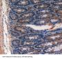Multidrug Resistance Associated Protein 1 (ABCC1) Antibody