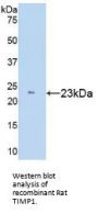 Metalloproteinase Inhibitor 1 (TIMP1) Antibody