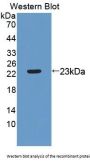 TIMP2 Antibody