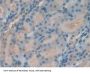 TIMP2 Antibody