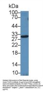 Metalloproteinase Inhibitor 2 (TIMP2) Antibody
