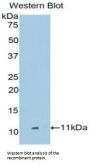 Metalloproteinase Inhibitor 2 (TIMP2) Antibody