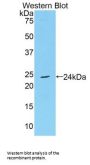 Metalloproteinase Inhibitor 4 (TIMP4) Antibody