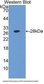 Ubiquitin Carboxyl Terminal Hydrolase L3 (UCHL3) Antibody