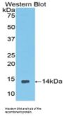 Coiled Coil Domain Containing Protein 60 (CCDC60) Antibody