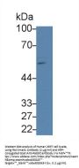 Mothers Against Decapentaplegic Homolog 1 (Smad1) Antibody