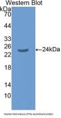 Mothers Against Decapentaplegic Homolog 1 (Smad1) Antibody