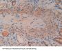 Mothers Against Decapentaplegic Homolog 1 (Smad1) Antibody