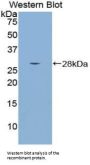 Mothers Against Decapentaplegic Homolog 4 (Smad4) Antibody