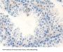 Mothers Against Decapentaplegic Homolog 4 (Smad4) Antibody