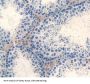 Mothers Against Decapentaplegic Homolog 4 (Smad4) Antibody