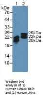 Neutrophil Gelatinase Associated Lipocalin / NGAL (LCN2) Antibody