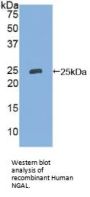 Neutrophil Gelatinase Associated Lipocalin / NGAL (LCN2) Antibody