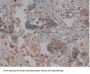 Neutrophil Gelatinase Associated Lipocalin / NGAL (LCN2) Antibody