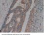 Neutrophil Gelatinase Associated Lipocalin / NGAL (LCN2) Antibody