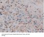 Neutrophil Gelatinase Associated Lipocalin / NGAL (LCN2) Antibody