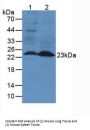 Neutrophil Gelatinase Associated Lipocalin / NGAL (LCN2) Antibody