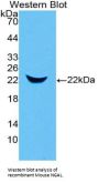Neutrophil Gelatinase Associated Lipocalin / NGAL (LCN2) Antibody