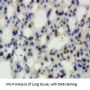 Neutrophil Gelatinase Associated Lipocalin / NGAL (LCN2) Antibody
