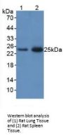 Neutrophil Gelatinase Associated Lipocalin / NGAL (LCN2) Antibody