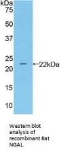 Neutrophil Gelatinase Associated Lipocalin / NGAL (LCN2) Antibody