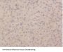 Neutrophil Gelatinase Associated Lipocalin / NGAL (LCN2) Antibody