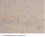 Neutrophil Gelatinase Associated Lipocalin / NGAL (LCN2) Antibody