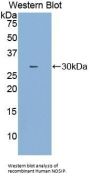 Nitric Oxide Synthase Interacting Protein (NOSIP) Antibody