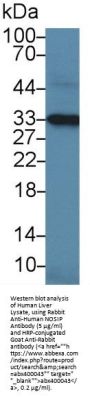 Nitric Oxide Synthase Interacting Protein (NOSIP) Antibody