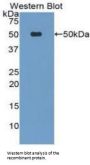 LpPLA2 Antibody