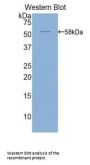 Activated Leukocyte Cell Adhesion Molecule / CD166 (ALCAM) Antibody