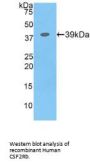 Colony Stimulating Factor 2 Receptor Beta (CSF2Rb) Antibody