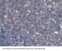 Colony Stimulating Factor 2 Receptor Beta (CSF2Rb) Antibody