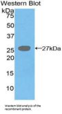 Diacylglycerol-O-Acyltransferase Homolog 1 (DGAT1) Antibody