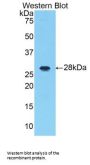 Interleukin 1 Receptor Associated Kinase 1 (IRAK1) Antibody
