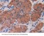 Interleukin 1 Receptor Associated Kinase 1 (IRAK1) Antibody
