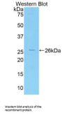 Interleukin 1 Receptor Associated Kinase 3 (IRAK3) Antibody