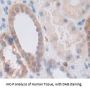 Interleukin 1 Receptor Associated Kinase 3 (IRAK3) Antibody