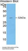 Mitogen-Activated Protein Kinase Kinase 7 (MAP2K7) Antibody